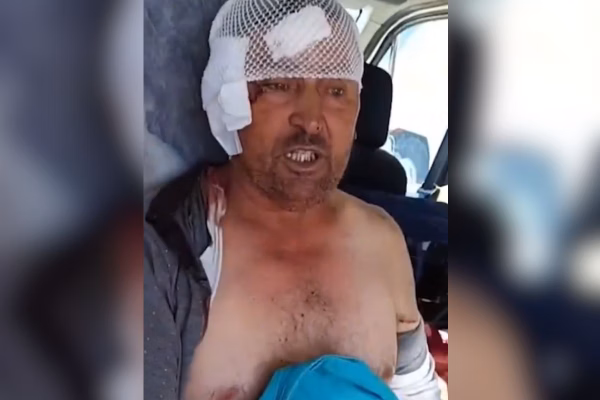 Leão foge de zoológico na Turquia, ataca homem e é abatido