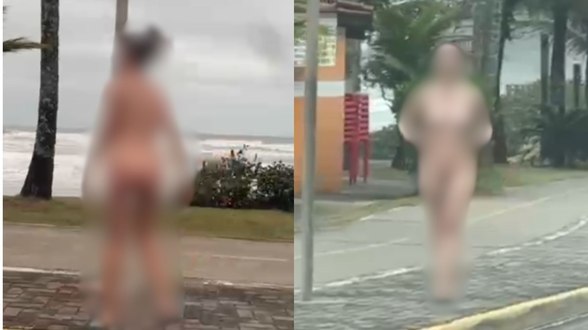 "Quilos Mortais": como está J.T., que pesava 404 kg e tinha linfedema grave