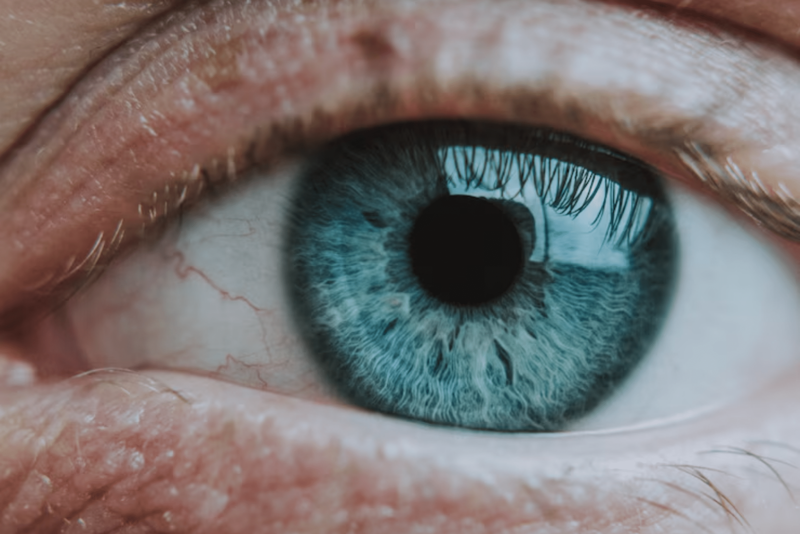 Curitiba reforça importância do cuidado com a saúde dos olhos – CBN Curitiba – A Rádio Que Toca Notícia