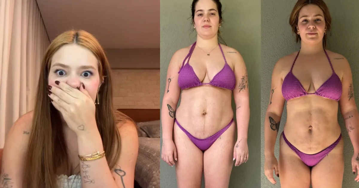 Viih Tube mostra resultado da lipo após 5 meses "Muito feliz"; veja